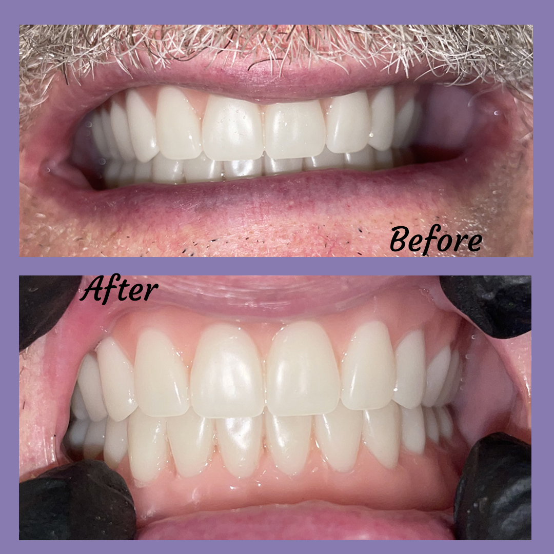 Before and After Image