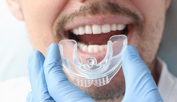Dental Mouth Guards in Price, UT