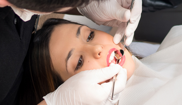 Root Canal Therapy in Price, UT